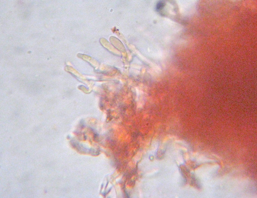 Steccherinum?